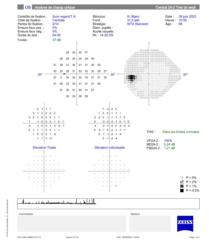 Appareil Tomographie par cohérence optique