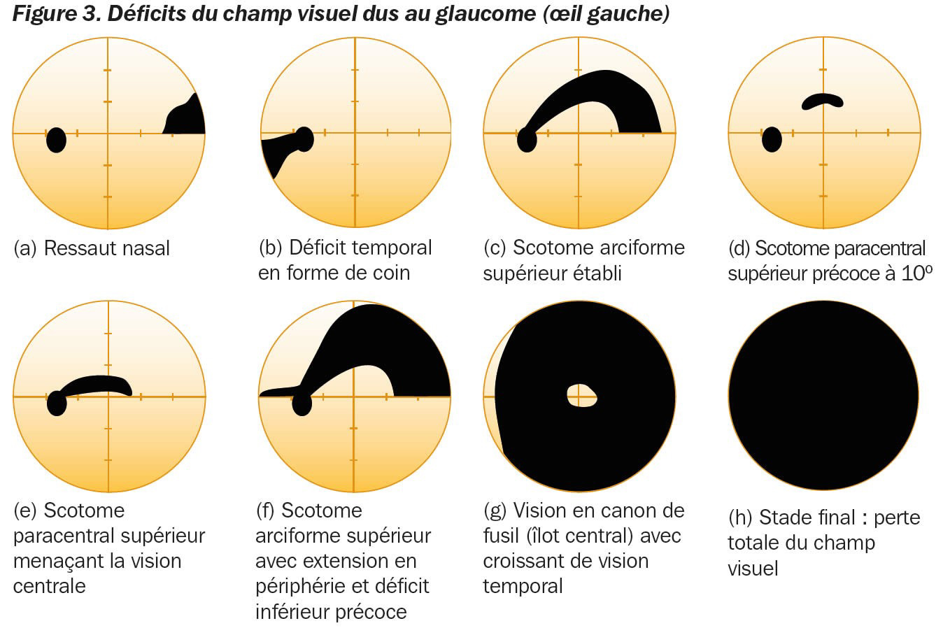Champ visuel Ma vision